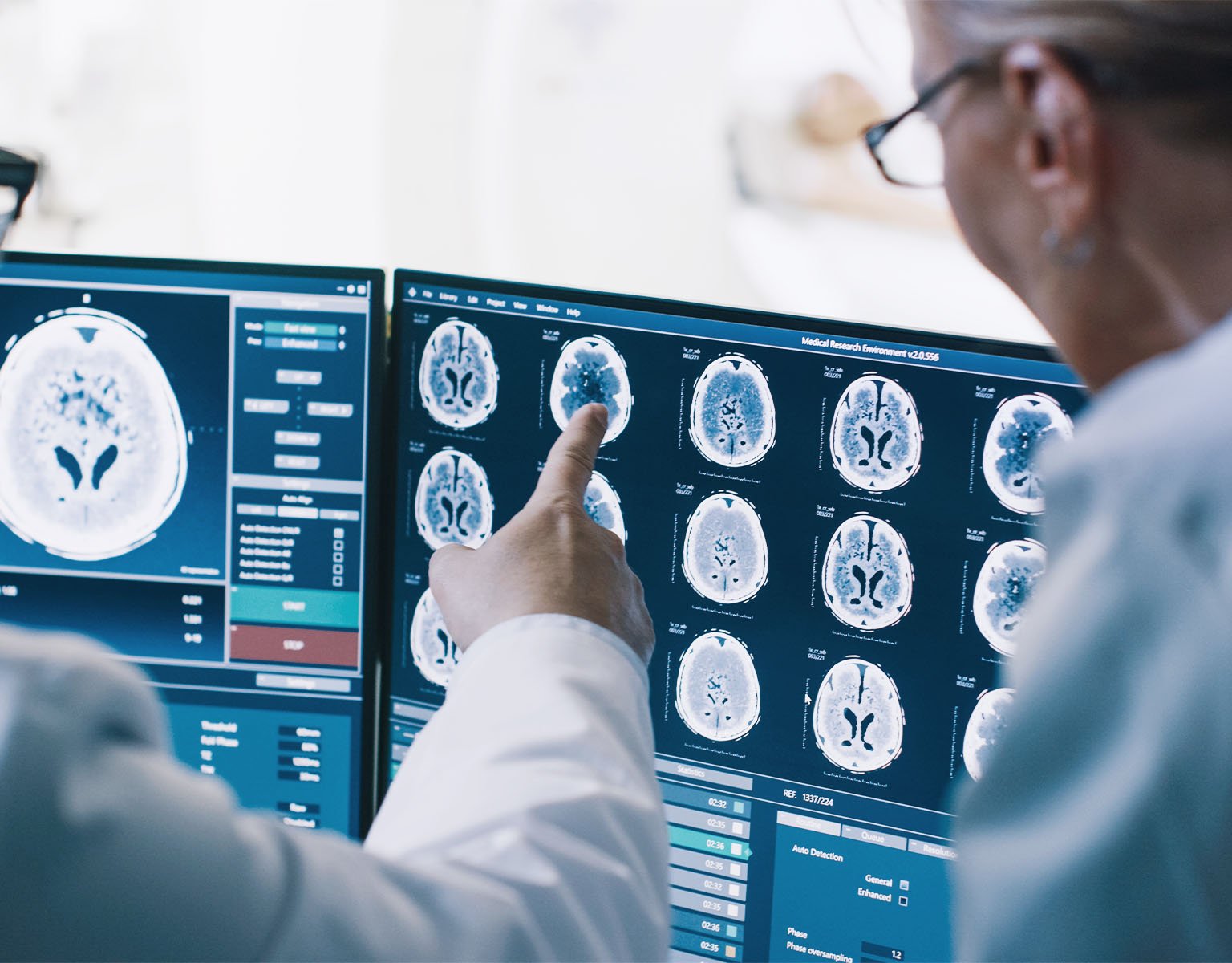 Oncology study data management